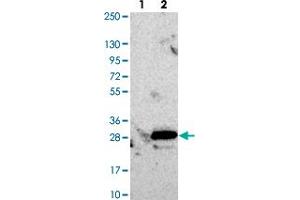Western blot analysis of Lane 1: Negative control (vector only transfected HEK293T lysate). (RCL 抗体)
