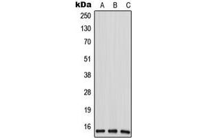 Western blot analysis of ANP32D expression in HeLa (A), mouse liver (B), rat liver (C) whole cell lysates.