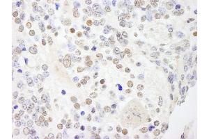 Immunohistochemistry (IHC) image for anti-Ankyrin Repeat and SAM Domain-Containing Protein 3 (ANKS3) (AA 606-656) antibody (ABIN7448411)