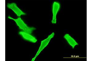 Immunofluorescence of monoclonal antibody to GUCY2D on HeLa cell. (GUCY2D 抗体  (AA 521-630))