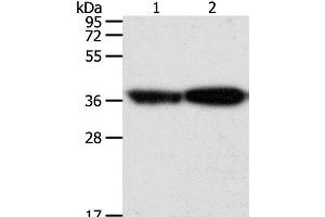 Western Blot analysis of Human leiomyosarcoma and Mouse testis tissue using TPM2 Polyclonal Antibody at dilution of 1:1000 (TPM2 抗体)