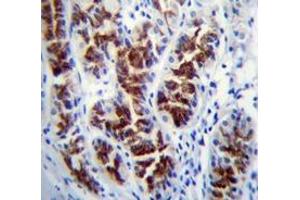 Immunohistochemistry analysis in human stomach tissue (Formalin-fixed, Paraffin-embedded) using PTPN20  Antibody , followed by peroxidase conjugated secondary antibody and DAB staining. (PTPN20 抗体  (Middle Region))