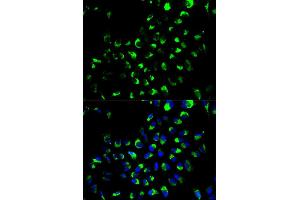 Immunofluorescence analysis of A549 cell using AK4 antibody. (AK4 抗体)