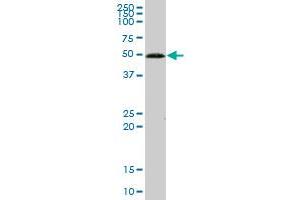 GCK MaxPab polyclonal antibody. (GCK 抗体  (AA 1-465))