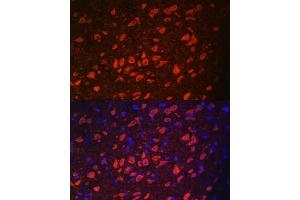Immunofluorescence (IF) image for anti-Transient Receptor Potential Cation Channel, Subfamily M, Member 2 (TRPM2) (AA 900-1000) antibody (ABIN6149582)
