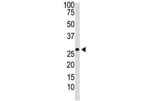 Image no. 1 for anti-Dickkopf 2 Homolog (DKK2) (N-Term) antibody (ABIN357069) (DKK2 抗体  (N-Term))