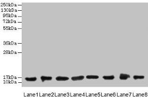 Western blot All lanes: COTL1 antibody at 8 μg/mL Lane 1: Mouse brain tissue Lane 2: Hela whole cell lysate Lane 3: Mouse kidney tissue Lane 4: HepG2 whole cell lysate Lane 5: Mouse thymus tissue Lane 6: U87 whole cell lysate Lane 7: HL60 whole cell lysate Lane 8: A549 whole cell lysate Secondary Goat polyclonal to rabbit IgG at 1/10000 dilution Predicted band size: 16 kDa Observed band size: 16 kDa (COTL1 抗体  (AA 2-142))