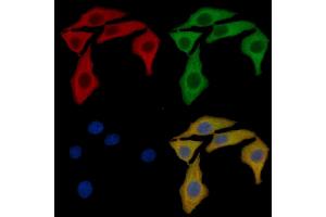 Annexin A2 Mouse Monoclonal Antibody staining HepG2 cells by IF/ICC. (Annexin A2 抗体  (N-Term))