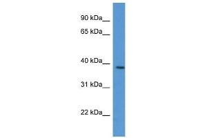 Western Blot showing VASP antibody used at a concentration of 1 ug/ml against Jurkat Cell Lysate (VASP 抗体  (C-Term))
