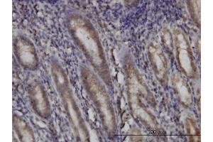 Immunoperoxidase of monoclonal antibody to DHODH on formalin-fixed paraffin-embedded human stomach. (DHODH 抗体  (AA 32-140))