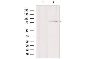 Western blot analysis of extracts from various samples, using RNF6 Antibody. (RNF6 抗体  (Internal Region))