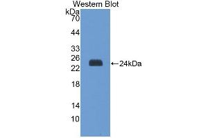 Western blot analysis of the recombinant protein. (SAT1 抗体  (AA 1-171))