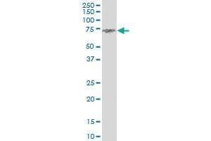 ENTH monoclonal antibody (M03), clone 1E6. (CLINT1 抗体  (AA 161-261))