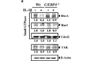Western Blotting (WB) image for anti-RAC1 (Center) antibody (ABIN2854858)