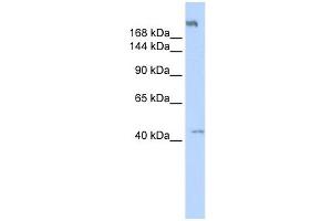 POLR3A antibody used at 1 ug/ml to detect target protein. (POLR3A 抗体  (Middle Region))