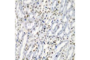 Immunohistochemistry (IHC) image for anti-Tumor Necrosis Factor (Ligand) Superfamily, Member 10 (TNFSF10) (AA 39-250) antibody (ABIN3023015)