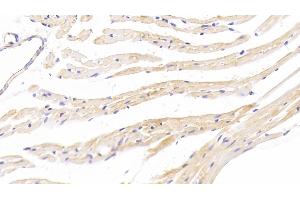Immunohistochemistry (IHC) image for anti-Tryptase beta 2 (TPSB2) (AA 30-276) antibody (ABIN7443440)