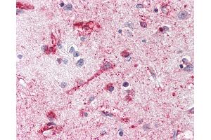 Anti-MC4R / Melanocortin 4 Receptor antibody IHC of human brain neurons and glia. (MC4R 抗体  (Cytoplasmic Domain))