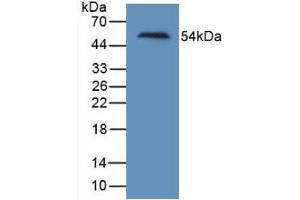 Figure. (HAVCR1 抗体  (AA 21-240))