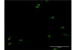 Immunofluorescence of monoclonal antibody to TCEA1 on HeLa cell.