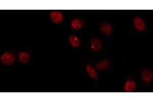 ABIN6266786 staining HT29 by IF/ICC. (MED17 抗体  (Internal Region))