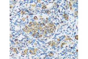Immunohistochemistry of paraffin-embedded Rat ovary using APOBEC3F Polyclonal Antibody at dilution of 1:100 (40x lens). (APOBEC3F 抗体)