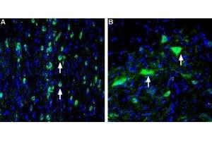 Expression of VAChT in rat medial septum and spinal cord - Immunohistochemical staining of perfusion-fixed frozen rat brain sections using Anti-Vesicular Acetylcholine Transporter (VAChT) Antibody (ABIN7043686, ABIN7044219 and ABIN7044220), (1:400), followed by goat-anti-rabbit-AlexaFluor-488. (SLC18A3 抗体  (C-Term, Cytosolic))