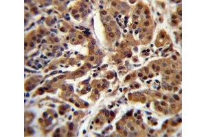 Immunohistochemistry (IHC) image for anti-V-Akt Murine Thymoma Viral Oncogene Homolog 1 (AKT1) (AA 428-457) antibody (ABIN3029453)
