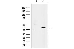 anti-Peripherin 2 (Retinal Degeneration, Slow) (PRPH2) (Internal Region) antibody