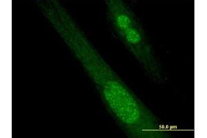Immunofluorescence of purified MaxPab antibody to SPANXB1 on Hs 181. (SPANXB1 抗体  (AA 1-103))
