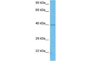 Host:  Mouse  Target Name:  PCBP1  Sample Tissue:  Mouse Brain  Antibody Dilution:  1ug/ml (PCBP1 抗体  (Middle Region))