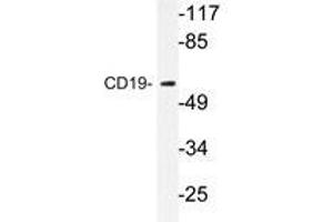 Western blot analysis of CD19 antibody in extracts from COS7 cells. (CD19 抗体)