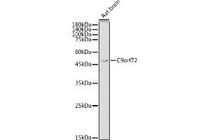 Western blot analysis of extracts of Rat brain, using C9orf72 antibody (ABIN7266391) at 1:1000 dilution. (C9ORF72 抗体  (AA 1-230))