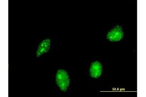Immunofluorescence of monoclonal antibody to HIC1 on HeLa cell. (HIC1 抗体  (AA 396-453))