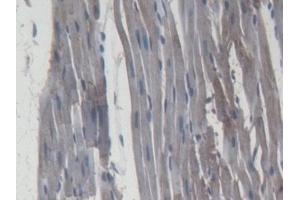 Immunohistochemistry (IHC) image for anti-Matrix Metallopeptidase 9 (Gelatinase B, 92kDa Gelatinase, 92kDa Type IV Collagenase) (MMP9) (AA 226-391) antibody (ABIN7427384)