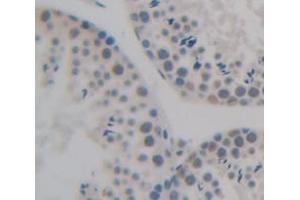 IHC-P analysis of Human Tissue, with DAB staining. (NAP1L1 抗体  (AA 2-289))