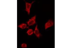 ABIN6276159 staining HeLa by IF/ICC. (OR4P4 抗体  (Internal Region))