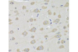 Immunohistochemistry of paraffin-embedded Rat brain using DHRS9 Polyclonal Antibody at dilution of 1:100 (40x lens). (DHRS9 抗体)