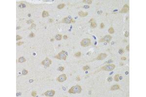 Immunohistochemistry of paraffin-embedded Rat brain using DHRS9 Polyclonal Antibody at dilution of 1:100 (40x lens). (DHRS9 抗体)