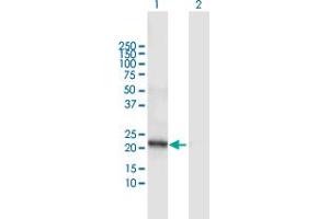 Western Blot analysis of DCAKD expression in transfected 293T cell line by DCAKD MaxPab polyclonal antibody. (DCAKD 抗体  (AA 1-231))