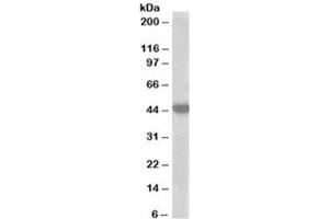 Western blot testing of A549 lysate with MCT2 antibody at 1ug/ml. (SLC16A7 抗体)