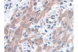 Detection of KIBRA in Mouse Uterus Tissue using Polyclonal Antibody to Kidney And Brain Protein (KIBRA)