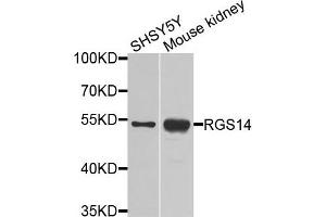 Western blot analysis of extracts of various cells, using RGS14 antibody. (RGS14 抗体)