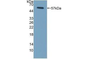 Detection of Recombinant FcgR3A, Mouse using Polyclonal Antibody to Fc Fragment Of IgG Low Affinity IIIa Receptor (FcgR3A) (FCGR3A 抗体  (AA 5-240))