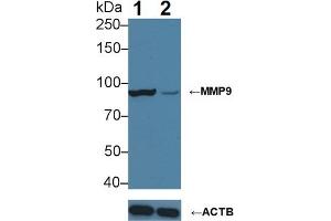 Knockout Varification: Lane 1: Wild-type HepG2 cell lysate; Lane 2: MMP9 knockout HepG2 cell lysate; Predicted MW: 76kDa Observed MW: 90kDa Primary Ab: 3µg/ml Mouse Anti-Human MMP9 Antibody Second Ab: 0. (MMP 9 抗体  (AA 213-399))