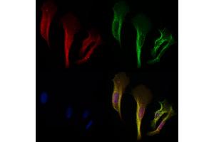 ABIN6257932 and ABIN6275132 staining Hela cells by IF/ICC. (ALDOB 抗体  (C-Term))