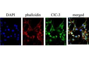 Expression of  in human D54 glioma cells. (CLCN3 抗体  (Intracellular))