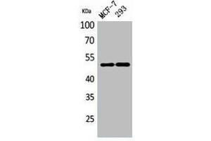 Western Blot analysis of MCF-7, 293 cells using PD-ECGF Polyclonal Antibody.