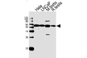 Lane 1: HeLa Cell lysates, Lane 2: LNCaP Cell lysates, Lane 3: Mouse testis lysates, Lane 4: Rat testis lysates, probed with ULK3 (1404CT148. (ULK3 抗体)