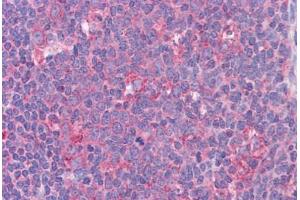 Immunohistochemistry (Formalin-fixed Paraffin-embedded Sections) (IHC (fp)) image for anti-Signal Transducer and Activator of Transcription 6, Interleukin-4 Induced (STAT6) (AA 614-663) antibody (ABIN6745701)